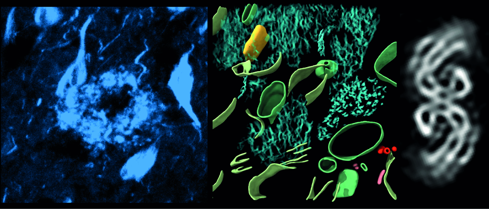 Funding boost for Seeing inside the brain by high-resolution cryo-electron tomography