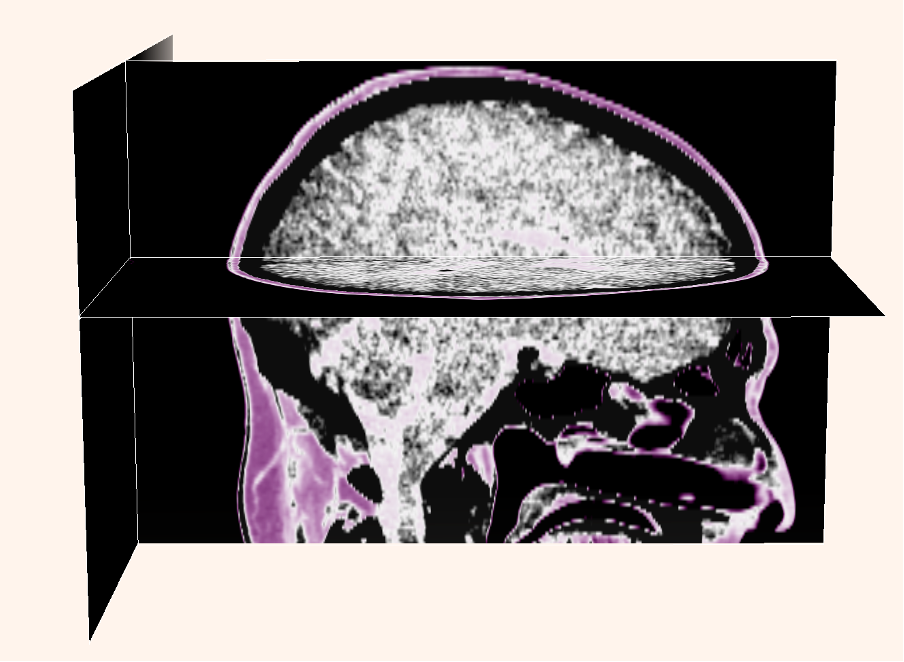 Brain